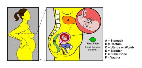 Pregnancy - 12 weeks