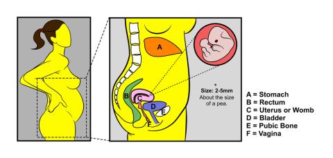 Pregnancy - 6 weeks