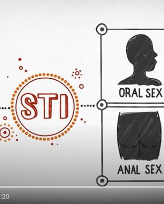 What is an STI?